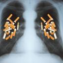 Attēls rakstam: Cigarešu smēķēšanas izraisīto slimību Top 5