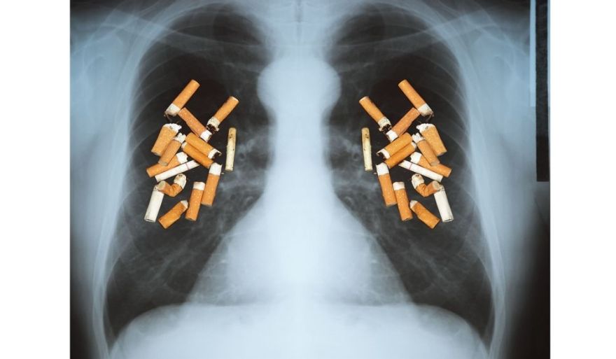Cigarešu smēķēšanas izraisīto slimību Top 5