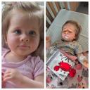 Attēls rakstam: Mazā Dārta cīnās par iespēju kustēties — ģimene lūdz palīdzību rehabilitācijai