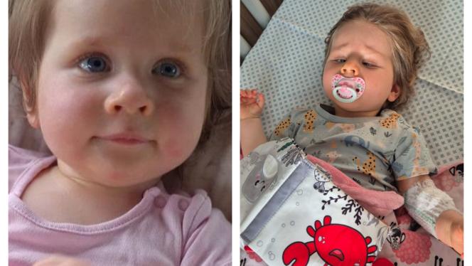 Attēls rakstam: Mazā Dārta cīnās par iespēju kustēties — ģimene lūdz palīdzību rehabilitācijai