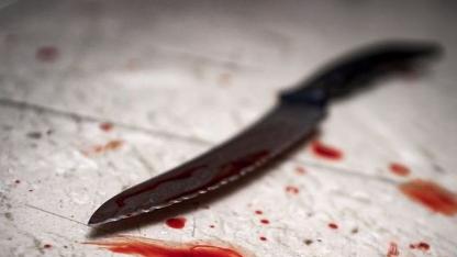 Attēls rakstam: Paķēra nazi un iedūra. Policija pabeigusi izmeklēšanu nogalinātā suņa lietā Jūrmalā