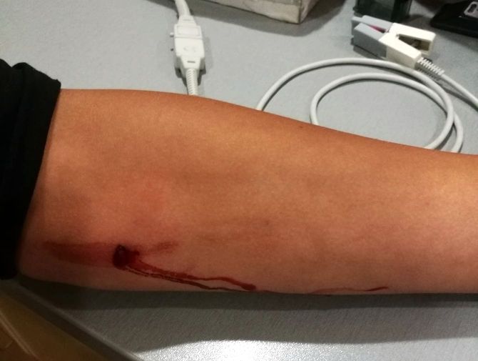 Policija skaidro, kādos apstākļos Piņķos rokā tika sašauts pusaudzis