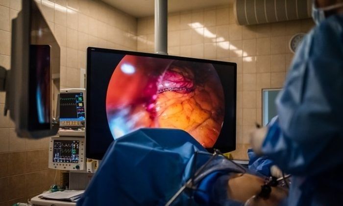 Siguldas slimnīcā pirmoreiz veikta operācija ar jauniegādāto laparoskopijas iekārtu