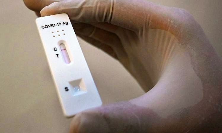 SPKC: Covid-19 slimnieku skaita samazinājums negarantē vīrusa neatgriešanos rudenī